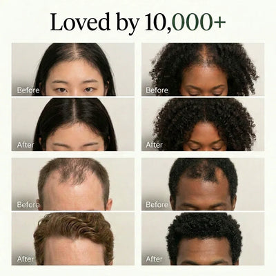 The Korean Scalp Revival Bar