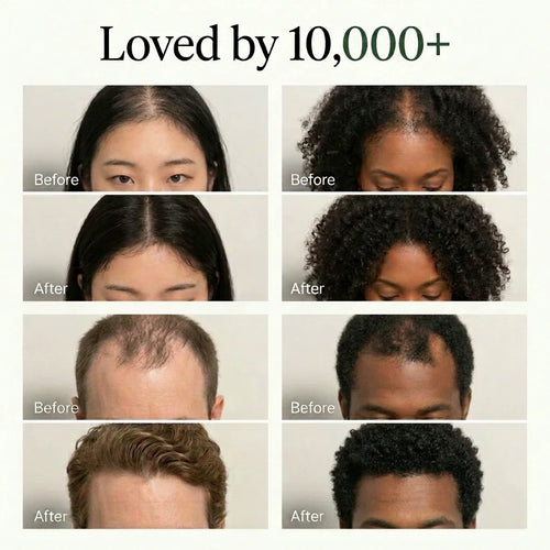The Korean Scalp Revival Bar